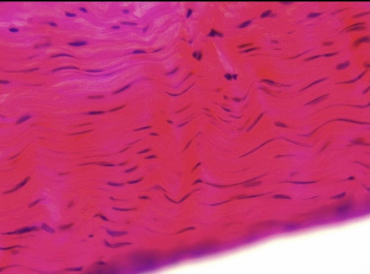 <p>Dense regular </p>