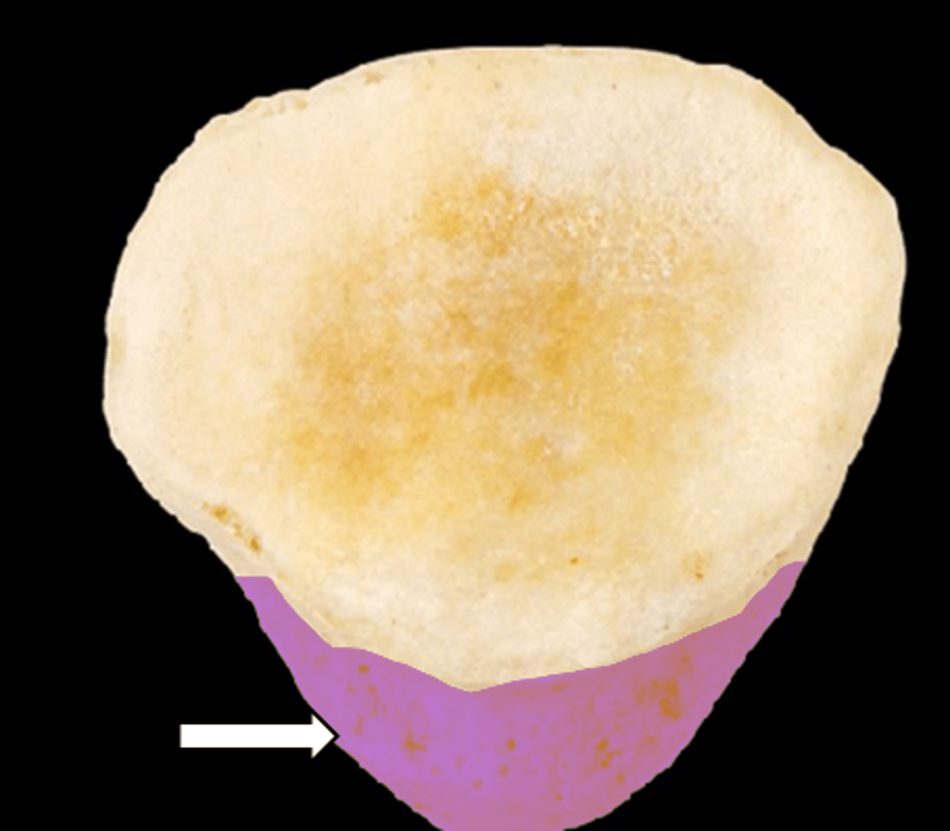 <p>name the part</p>