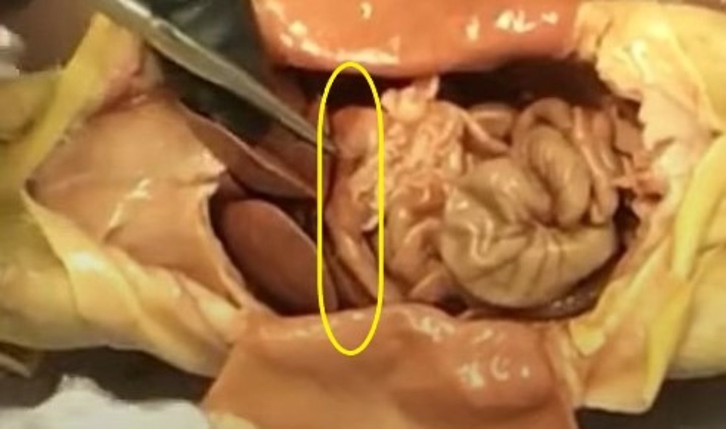 <p>stomach: digestion</p>