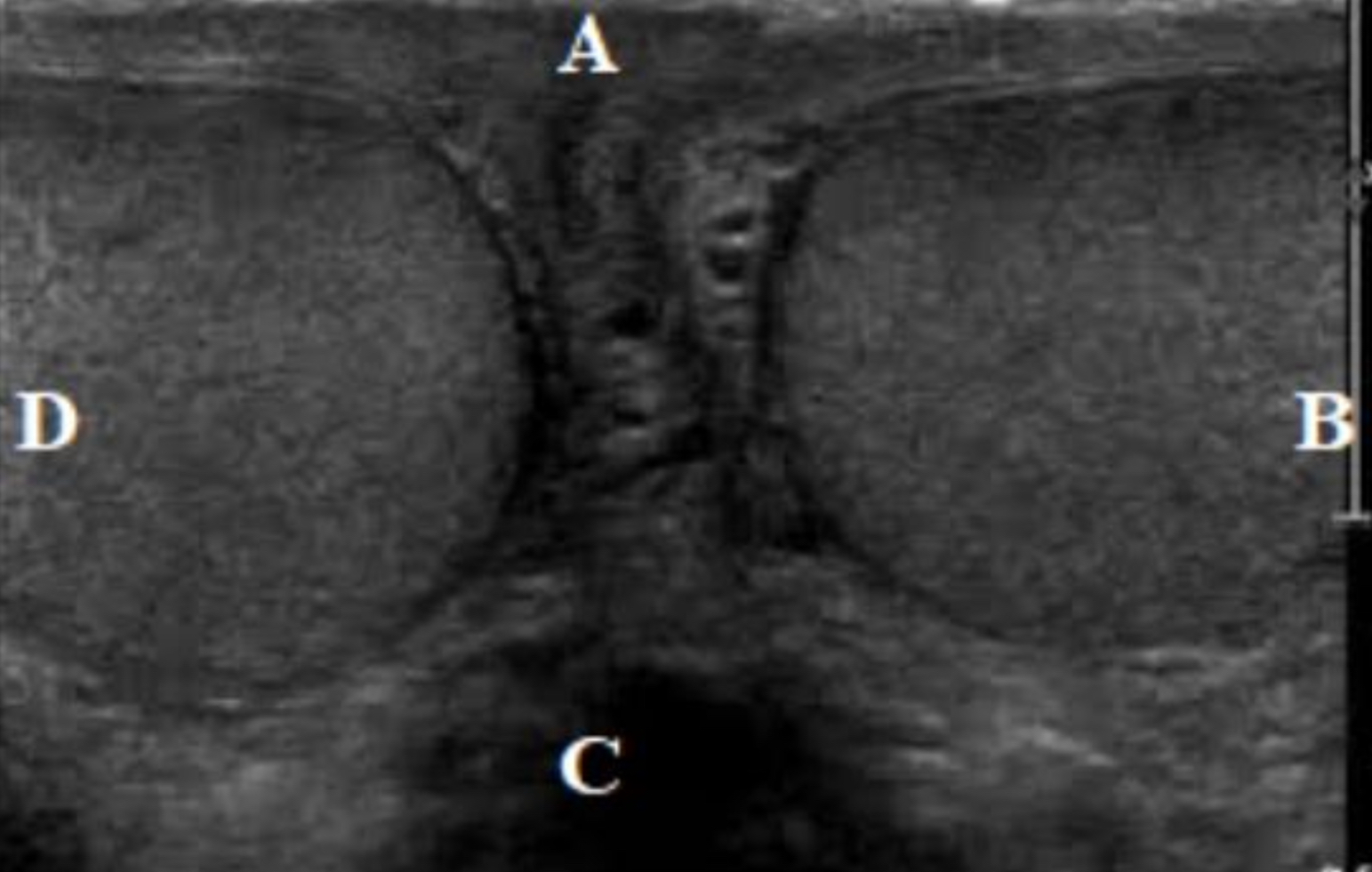 <p>Which is RT?</p><p>Which is LT?</p><p>Which is superior?</p><p>Which is inferior?</p><p>Which is anterior?</p><p>Which is posterior?</p>