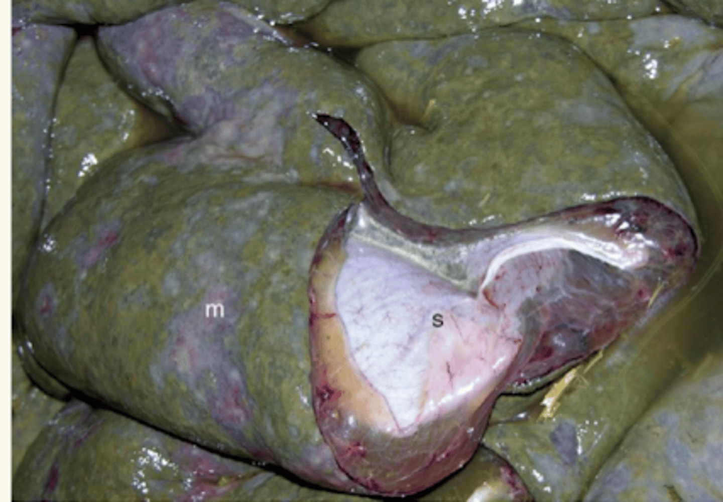 <p>diagnóstico morfológico y etiológico"</p>