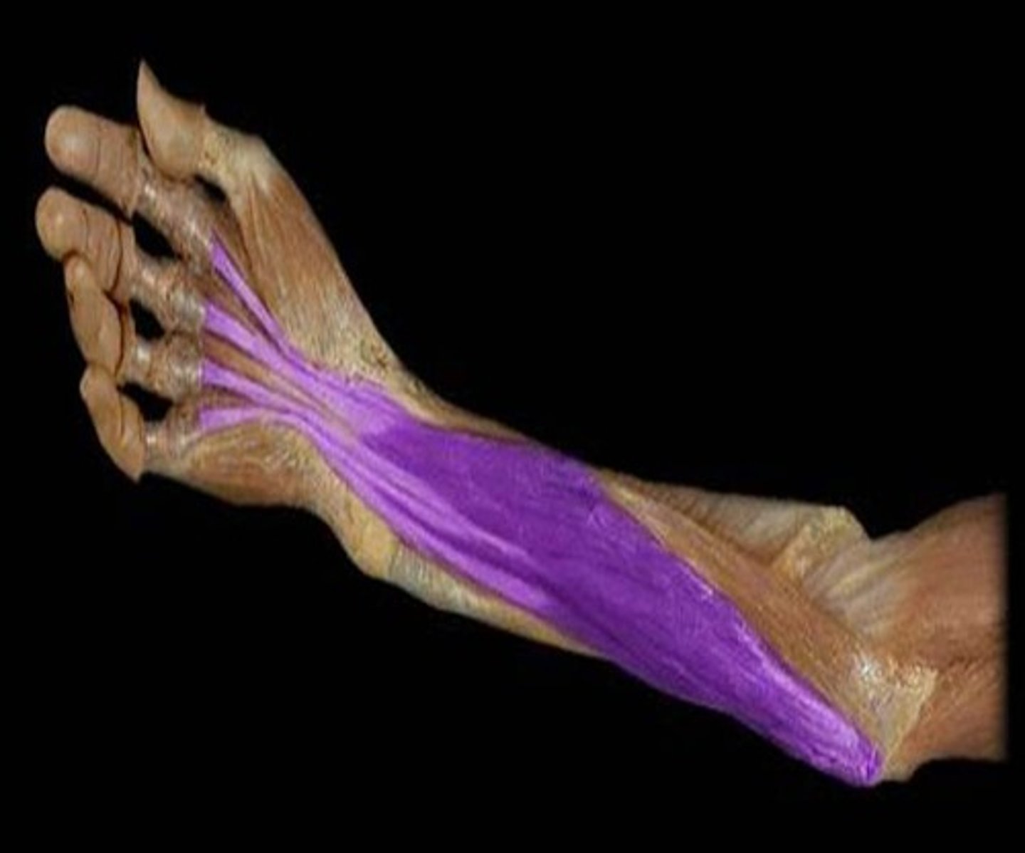 <p>What is the name of this muscle, highlighted in purple?</p>