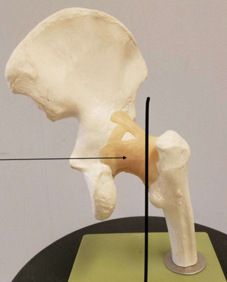 <p>in the back</p><p>ischium to femur</p>