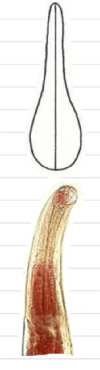 <p>what type of esophagus is this?</p>