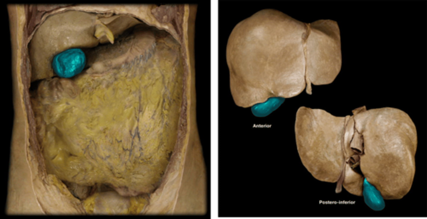 <p>Identify this accessory digestive organ.</p>