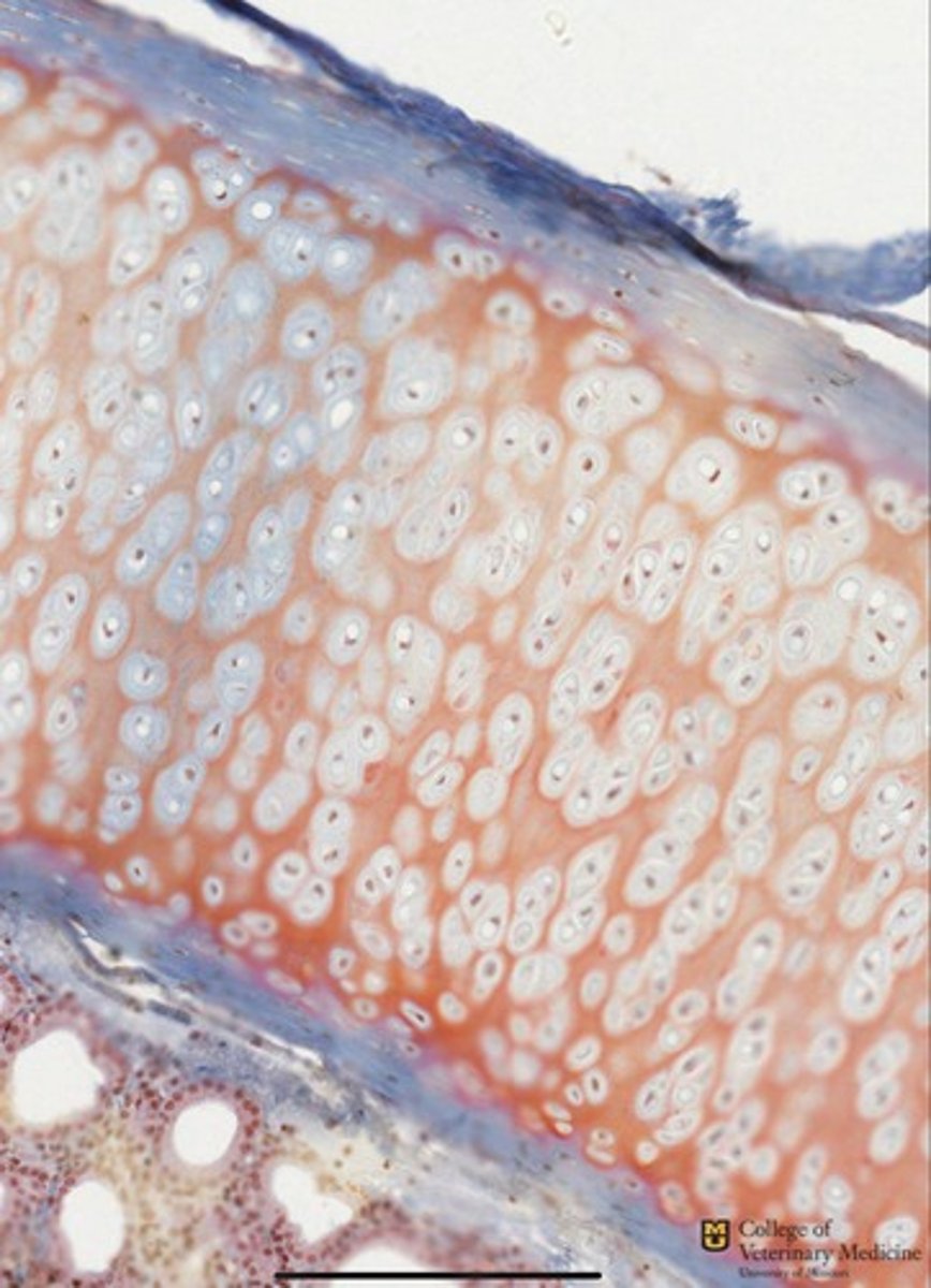 <p>What type of cartilage is depicted?</p>