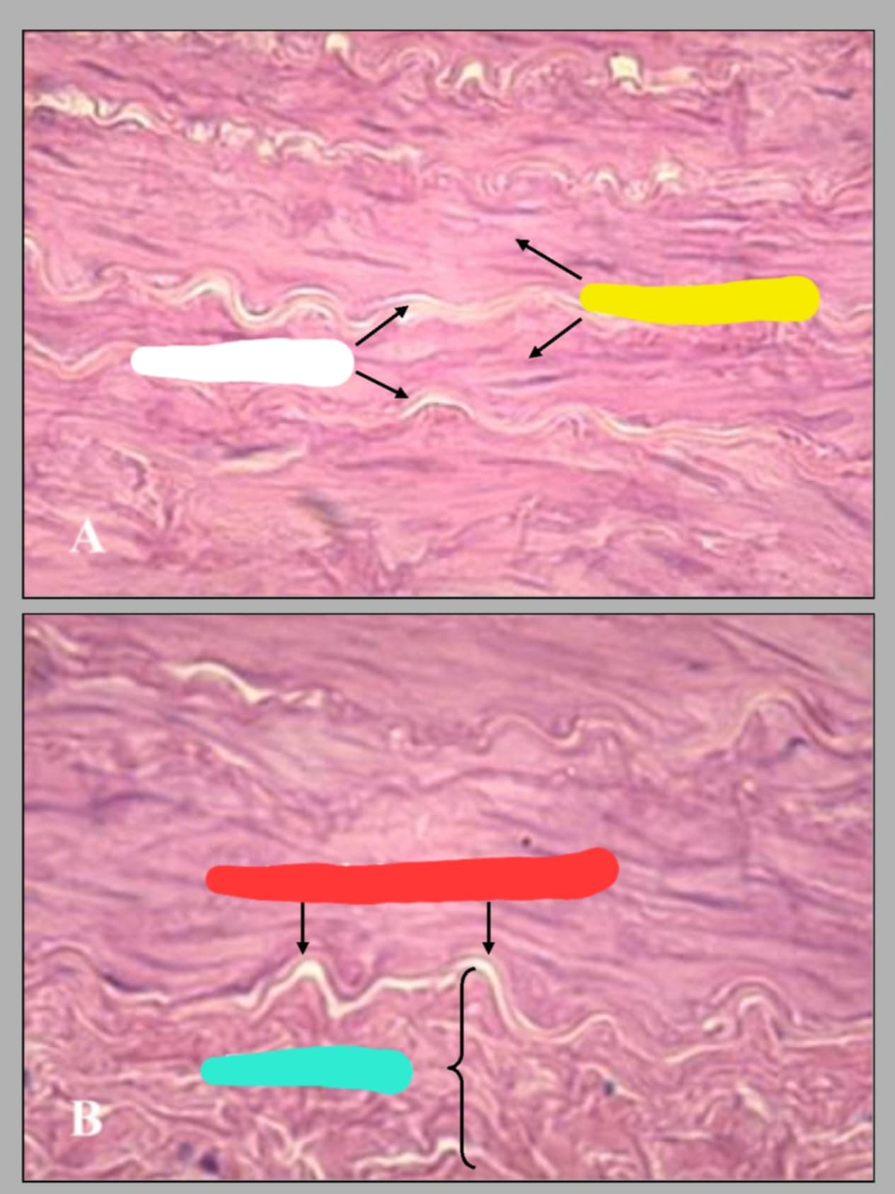<p>name the parts in this wall of common carotid artery</p>