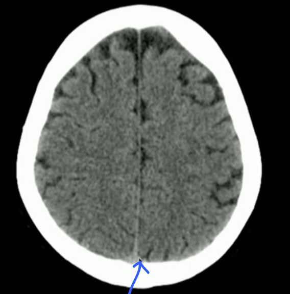 <p>What is the arrow pointing to? + Attachment Points</p>