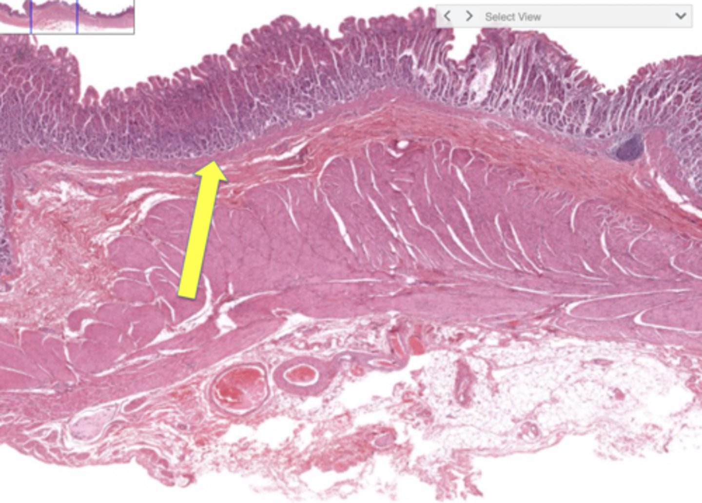 <p>smooth muscle that produces local movements of mucosa in the stomach</p>