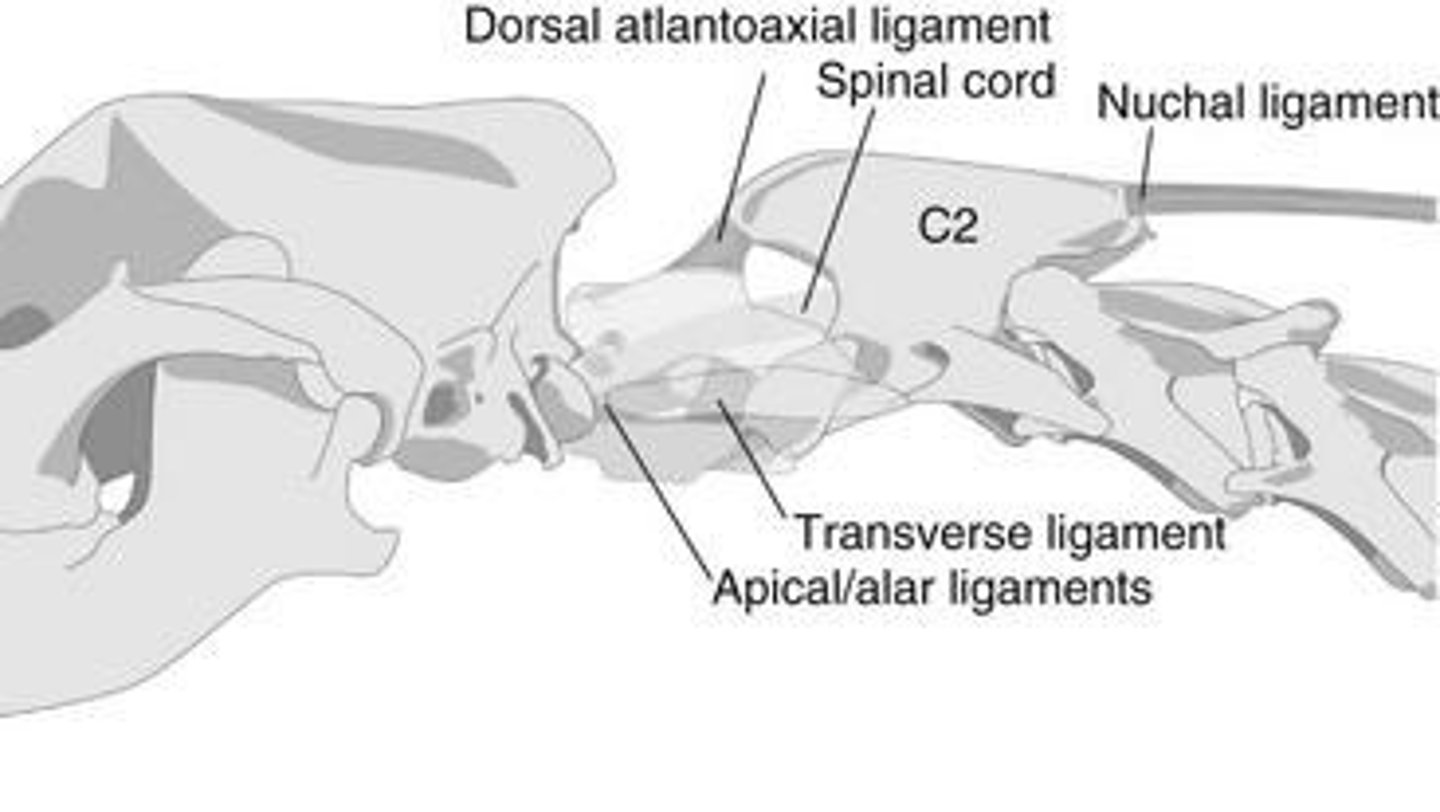 <p>Joint between atlas and axis vertebrae.</p>