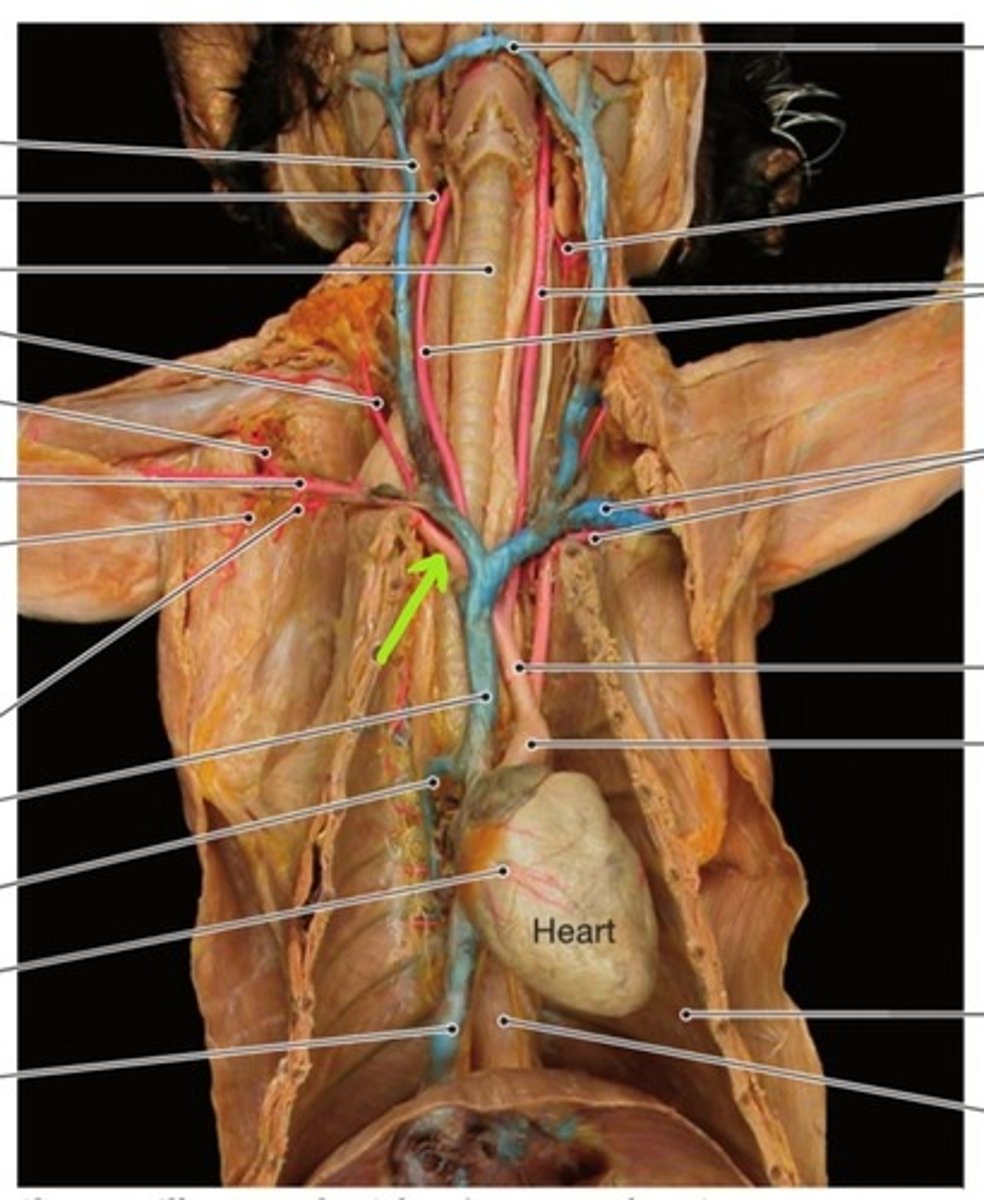 <p>identify this artery</p>