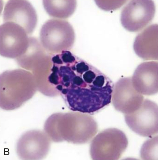 <p>Identify cell and abnormality</p>