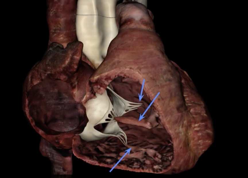 <p>What are the blue arrows pointing to?</p>