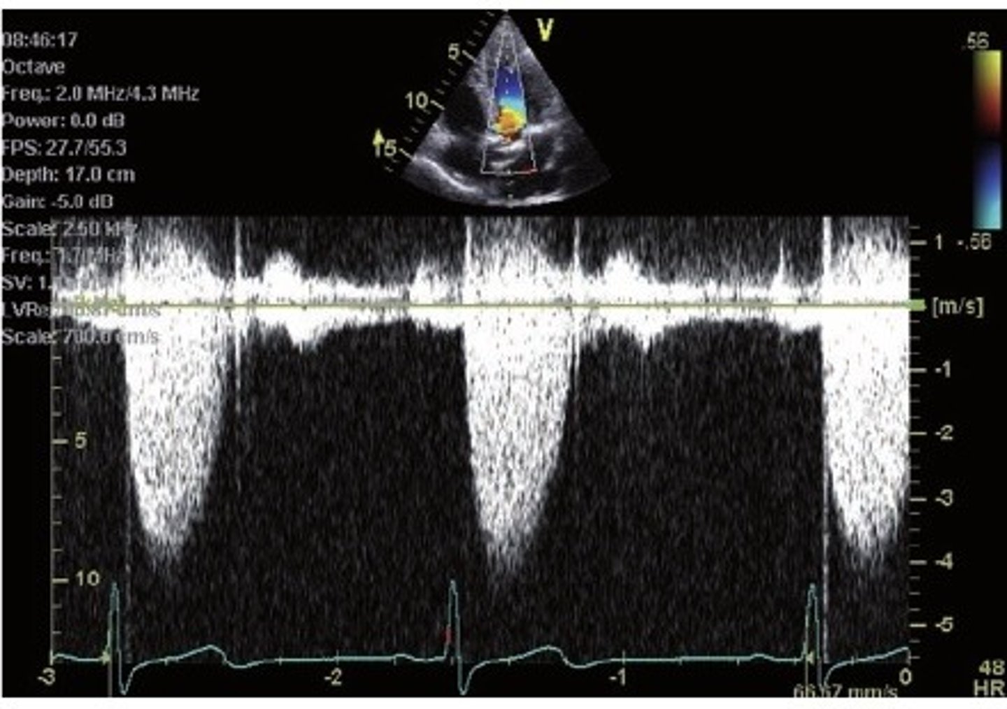 <p>which type of quantitative doppler is this? How can you tell?</p>