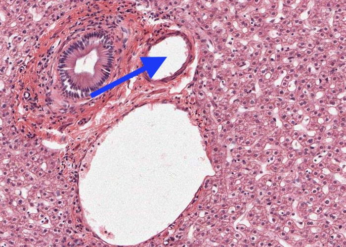 <p>The circular structure (x10) whose lumen is arrowed is a?</p>