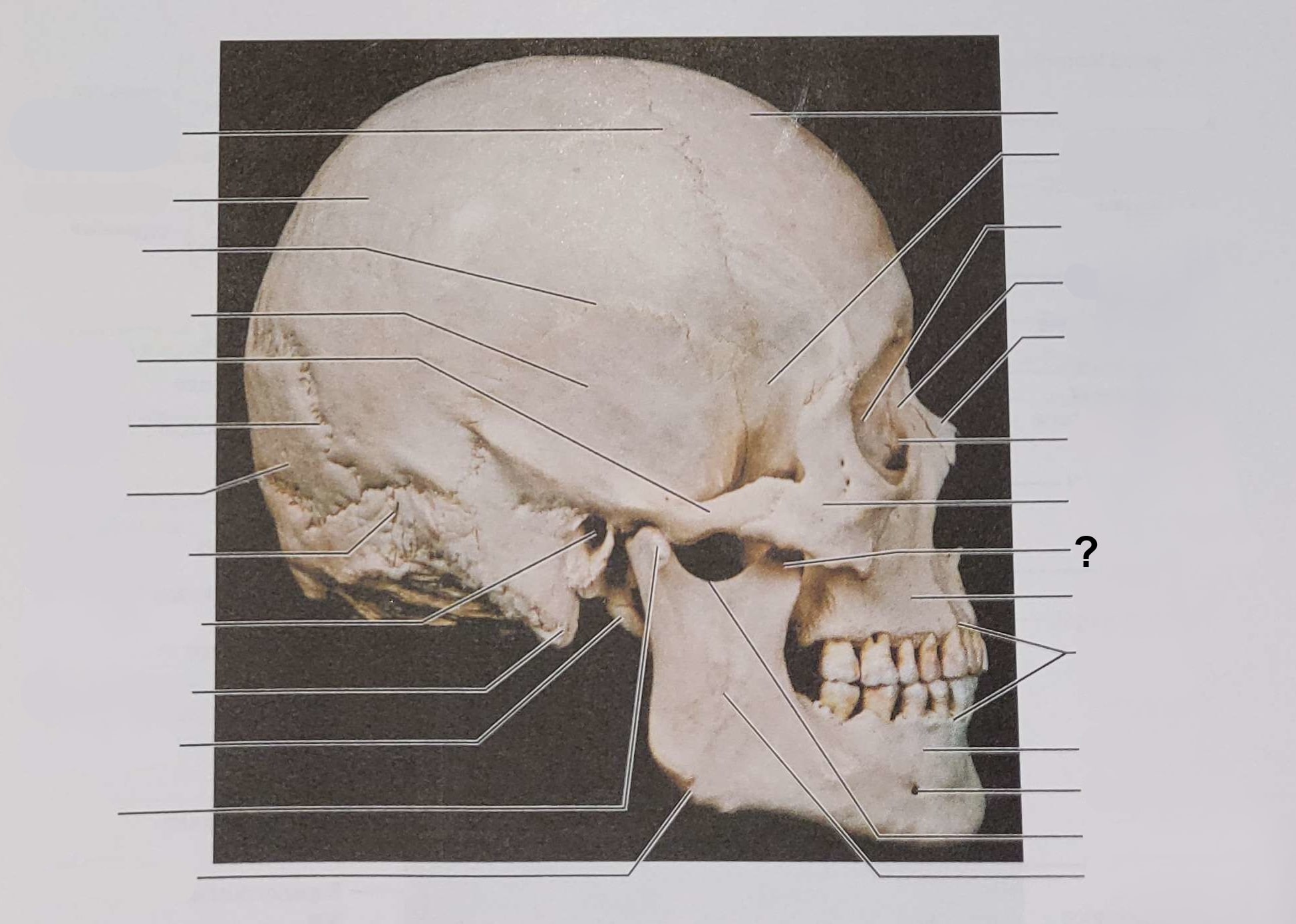 <p>Name the indicated structure</p>