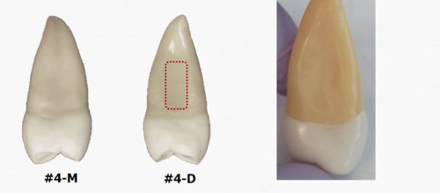<p>Secondary Premolars have a mesial and distal __</p>