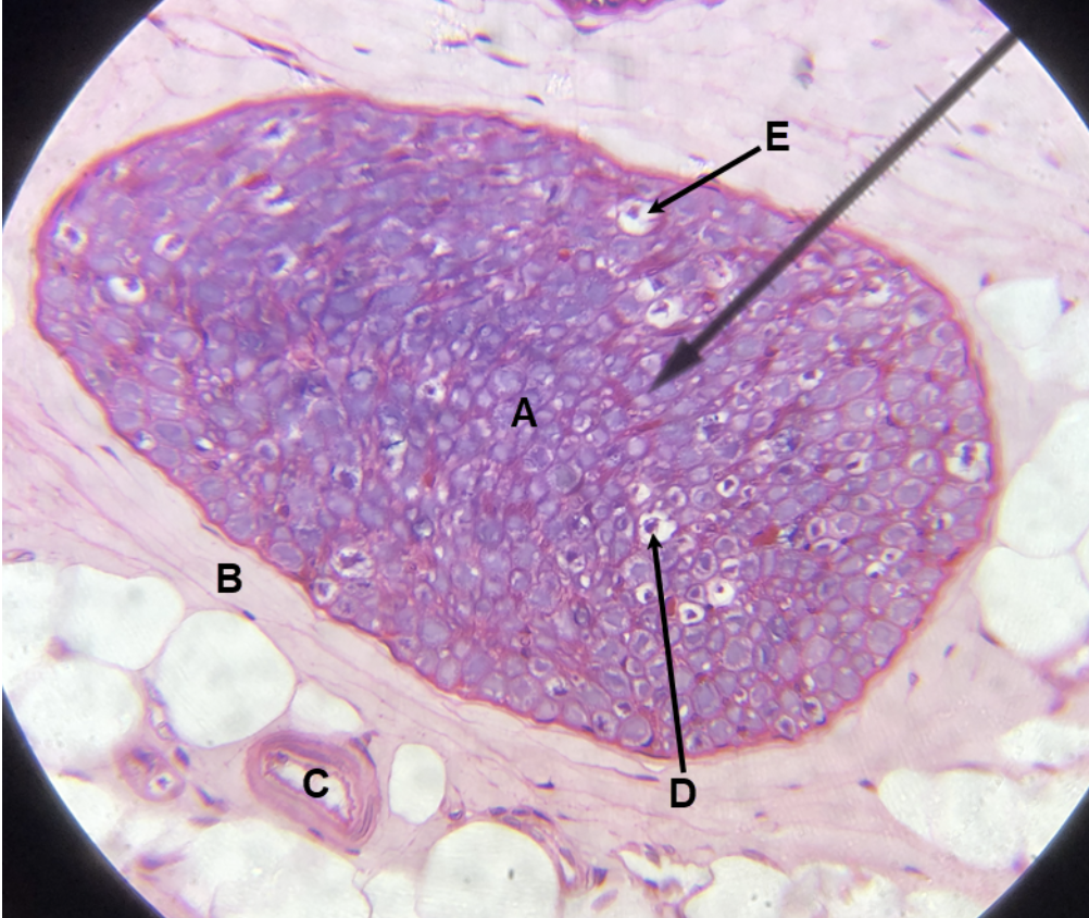 <p><span><span>In the image above, identify structures A-E. (Hint: D is purple, E is white.)</span></span></p>