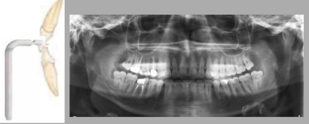 <p>Error: patient too far back</p>