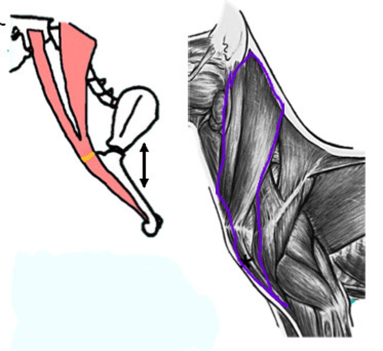 <p>What muscle is presented in this image?</p>