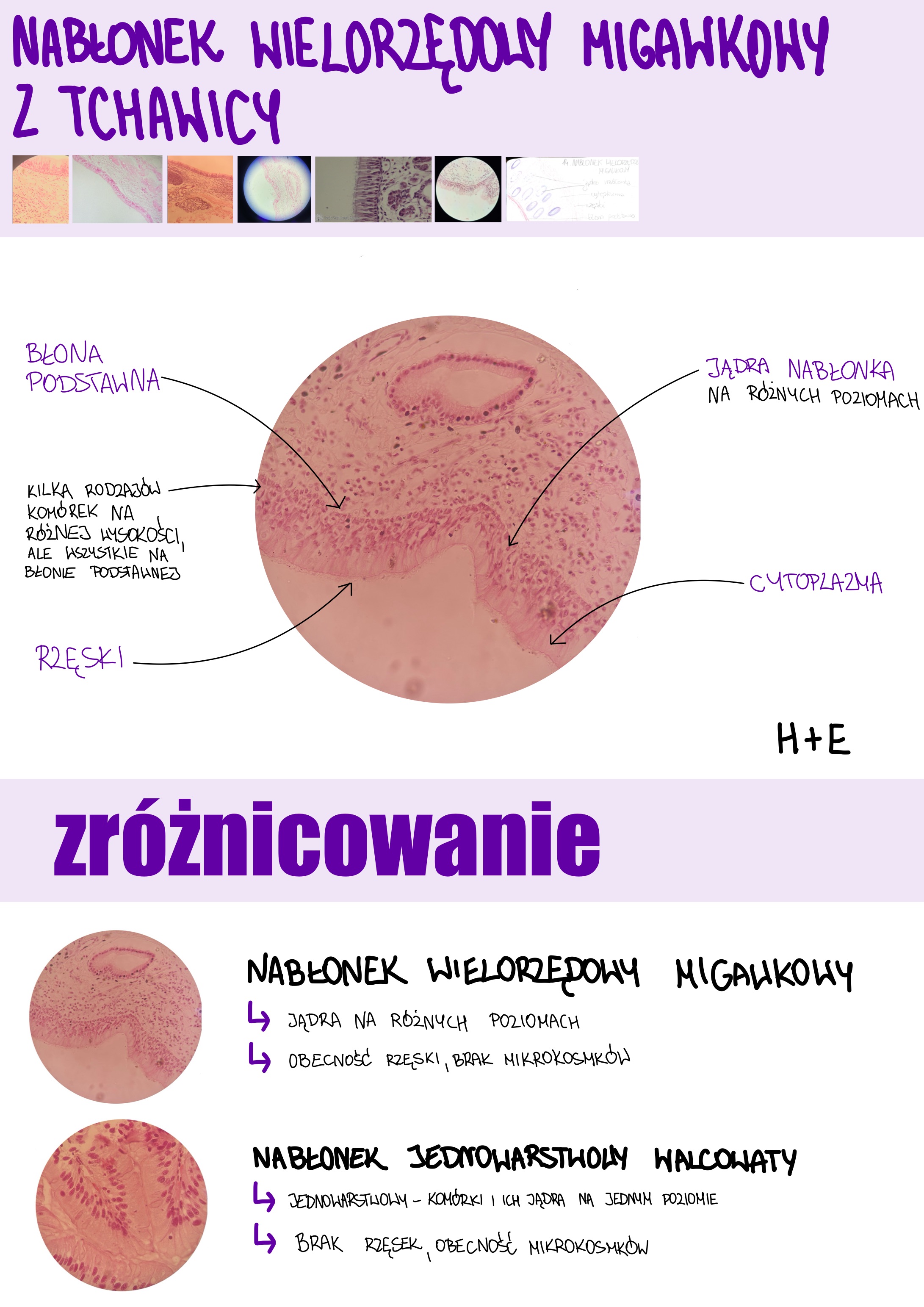 <p>Nabłonek wielorzędowy migawkowy z tchawicy</p>