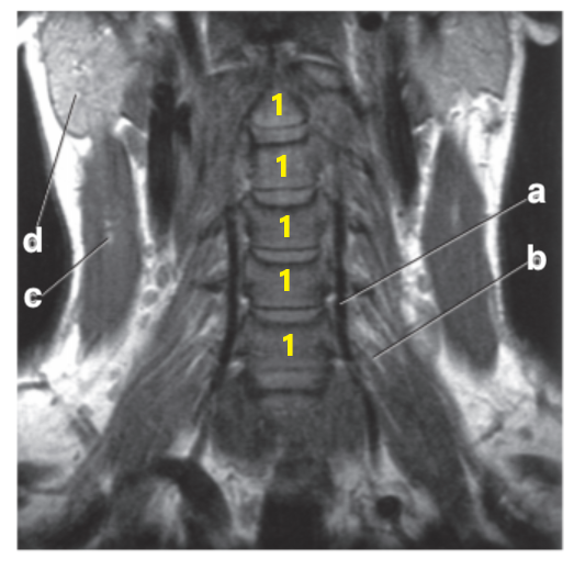 <p>What is letter a?</p>