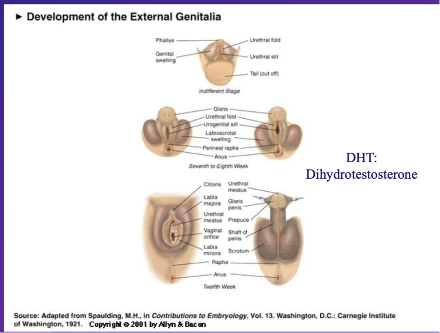 <p>initially undifferentiated –regardless of XY or XX embryo</p><p class="MsoNormal">7-8weeks -  once gonad has turned into testes or ovary, the external genitalia are sensitive to androgynes – particularly dihydrotestosterone</p><p class="MsoNormal"></p><p class="MsoNormal">DHT - ( a hormone produced by the testes which binds to specific receptors and is required to turn external anatomy into male specific external anatomy e.g. scrotum, penis e.t.c)</p><p class="MsoNormal"></p><p class="MsoNormal">if XY - </p><p class="MsoNormal">testes produce DHT  , DHT binds to specific receptors and triggers the development of undifferentiated external anatomy into male specific external anatomy </p><p class="MsoNormal"></p><p class="MsoNormal">XX chromosomes </p><p class="MsoNormal"></p><p class="MsoNormal">if testes not present or cant perform its function due to e.g. absence of receptors , no DHT will produced to trigger male specific development and so female specific external anatomy will develop</p><p class="MsoNormal"></p><p class="MsoNormal">i.e. what would become a</p><p class="MsoNormal">scrotum in a male developes into the external labia in females</p><p class="MsoNormal">penis shaft in a male developes into the internal labia</p><p class="MsoNormal">male glands would become a clitoras</p><p class="MsoNormal">gonads production of hormones which influenced development of internal and external sex specific hormones</p>