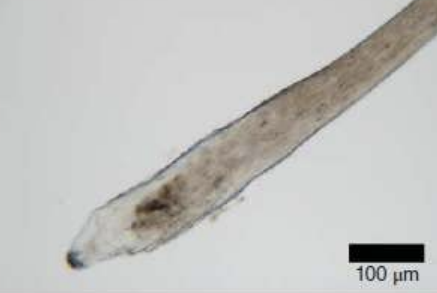 <ul><li><p>root bulb will be forming and starting to keratinize</p></li><li><p>Some root sheath may be present</p></li><li><p></p></li></ul><p></p>