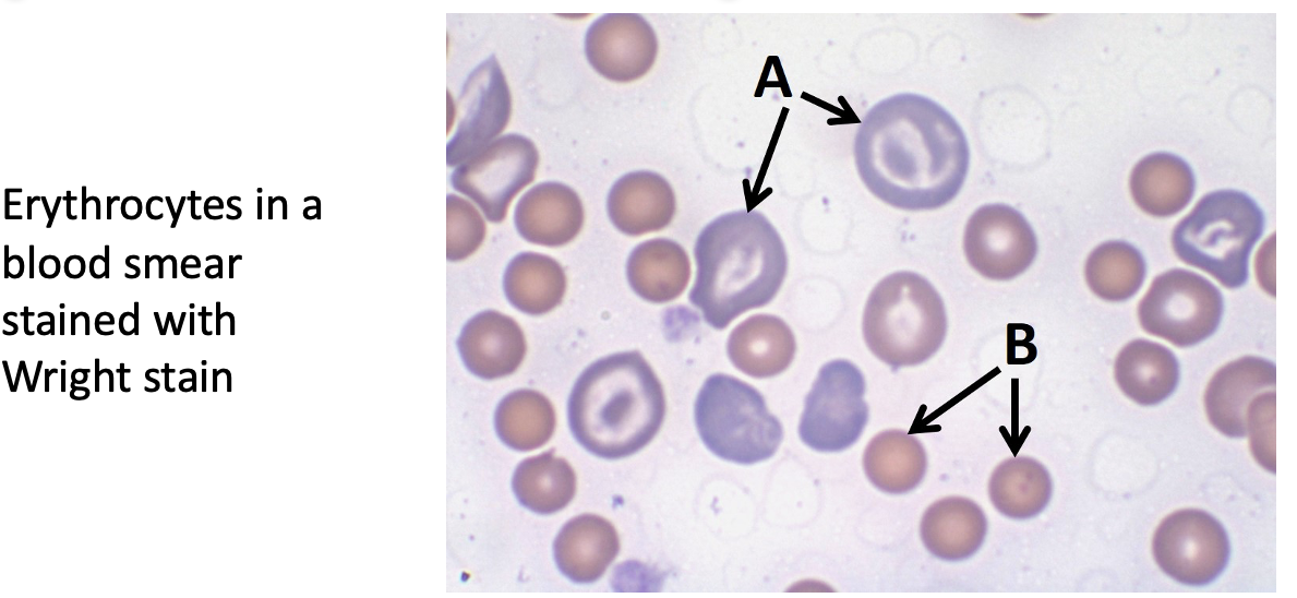 <p><span style="font-family: &quot;Calibri Light&quot;;"><strong>Immature RBC contain ribosomes, while mature RBC do not.</strong></span><span><strong>&nbsp; </strong></span><span style="font-family: &quot;Calibri Light&quot;;"><strong>Which of the indicated cells are immature RBC?</strong></span></p>