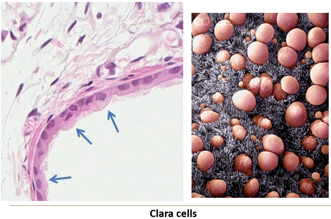 <p><strong>Pseudostratified epithelium</strong> containing:</p><ol><li><p><strong>Goblet cells</strong> – Secrete mucus.</p></li><li><p><strong>Clara cells</strong> – Secrete <strong>surfactant-like substances</strong>.</p></li><li><p><strong>Enteroendocrine cells</strong> – Secrete <strong>bioactive amines and peptides</strong> into blood vessels.</p></li></ol><p></p>
