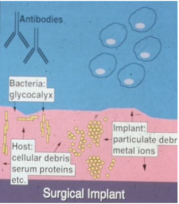 <p><span>A network of polysaccharides lying outside the outer membrane of the gram-negative cells and outside the peptidoglycan of gram-positive cells.&nbsp;</span><br><br><span>The bacteria produce exopolysaccharide polymers which assist the cell to firmly adhere to tissues or implants. Bacteria produce inside the glycocalyx and form colonies that coalesce to form a biofilm.</span></p>