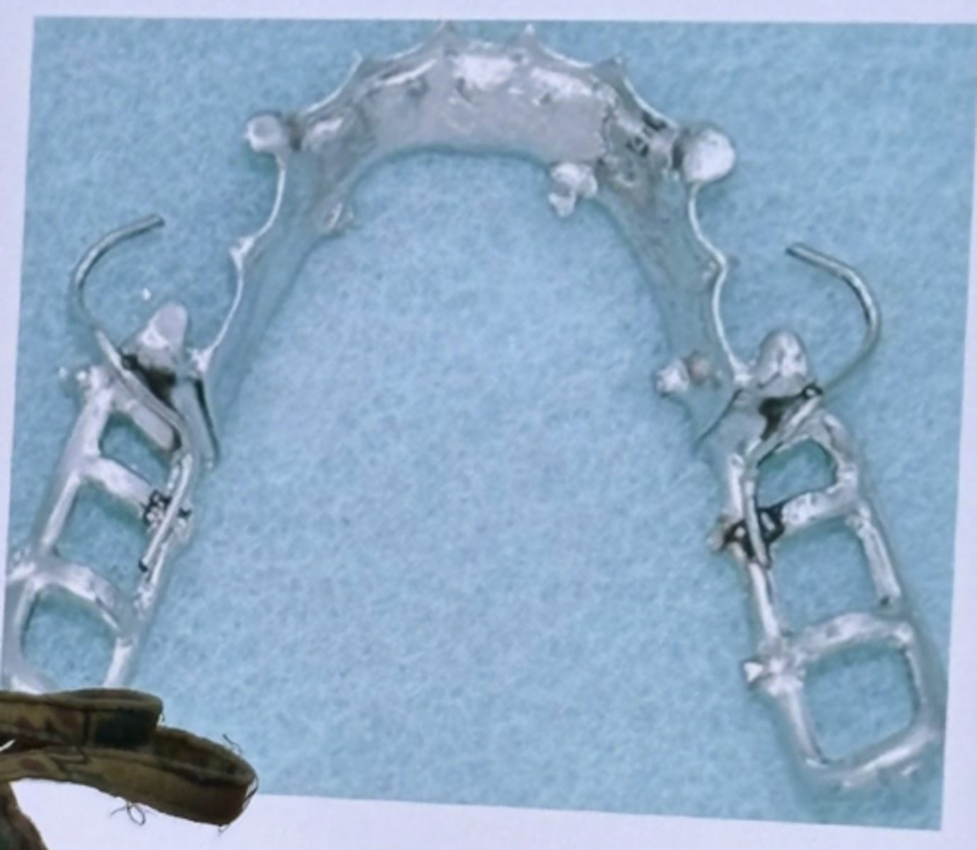 <p>-they use a 0.02 undercut</p><p>-its more flexible to engage deeper undercuts</p>