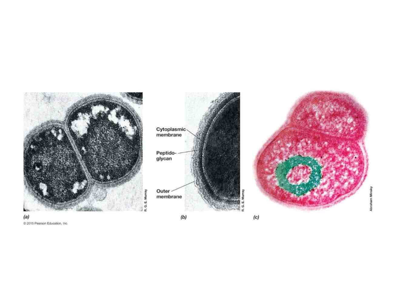 <p>Extremely resistant to radiation and great DNA repair bacteria.</p>