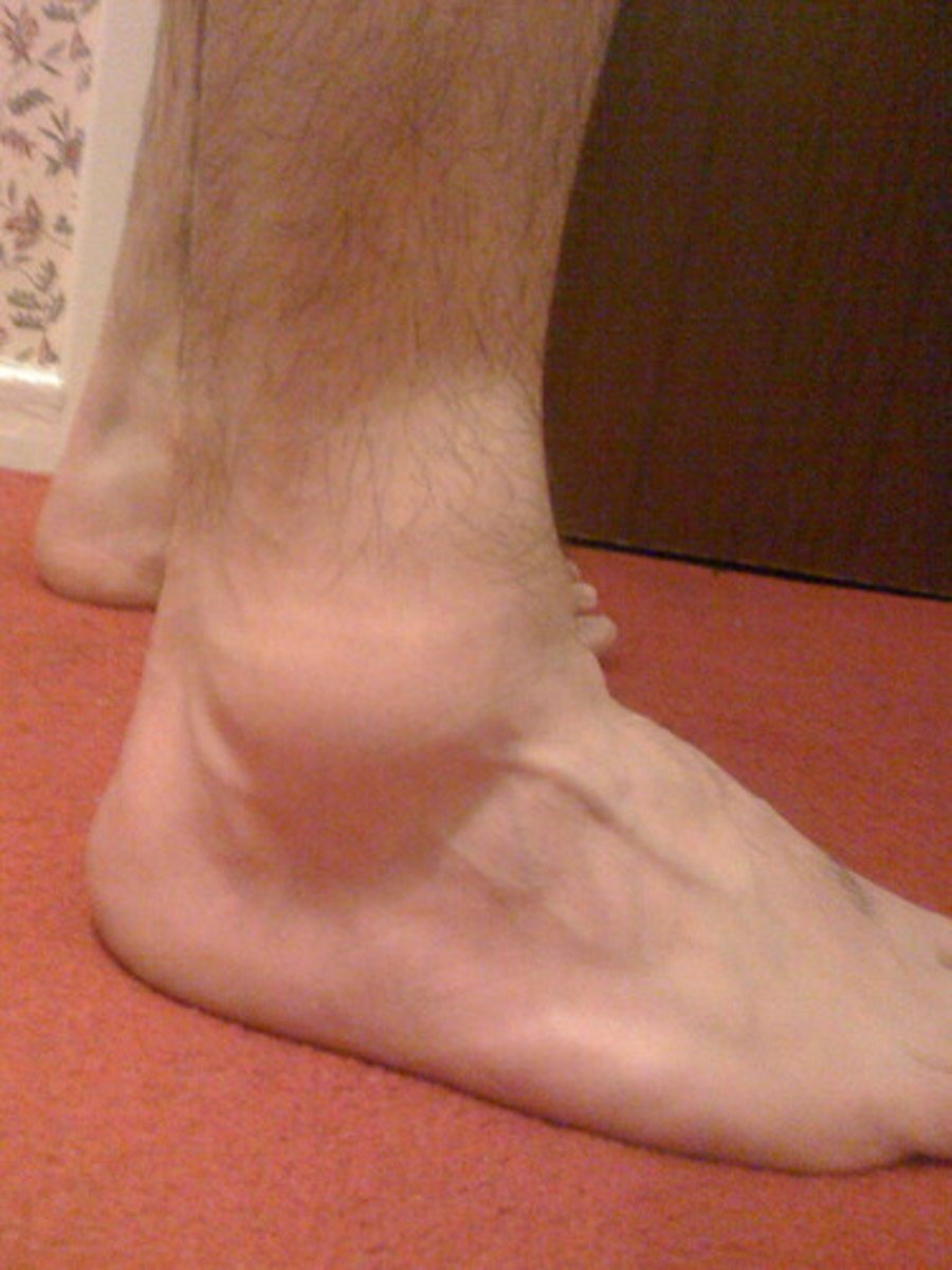 <p>ankle</p>