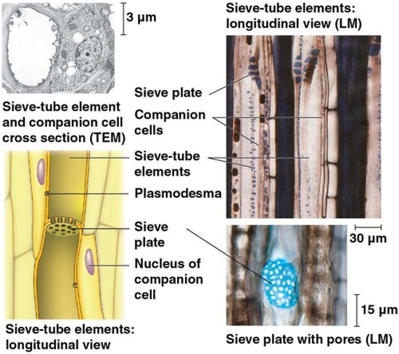 <p>To transport sugars from leaves to other parts of the plant.</p>