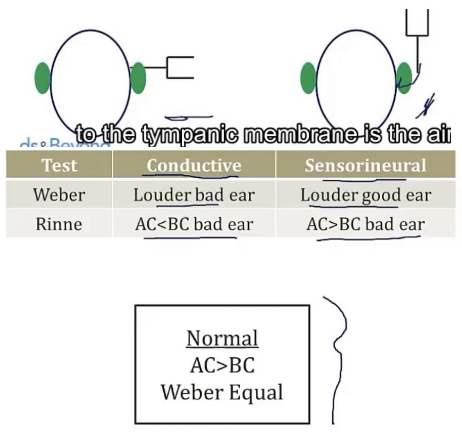 <p>-hearing</p><p>-tuning fork, at the mastoid process behind the ear; no longer hears it; to just outside the ear; if they can still hear it</p><p>-air conduction greater than bone conduction</p><p>-patient CANNOT hear when it’s next to the ear, so bone conduction is greater than air conduction</p><p>-patient CAN hear when it’s next to the ear, but both bone conduction and air conduction are reduced, but air conduction is still greater</p>