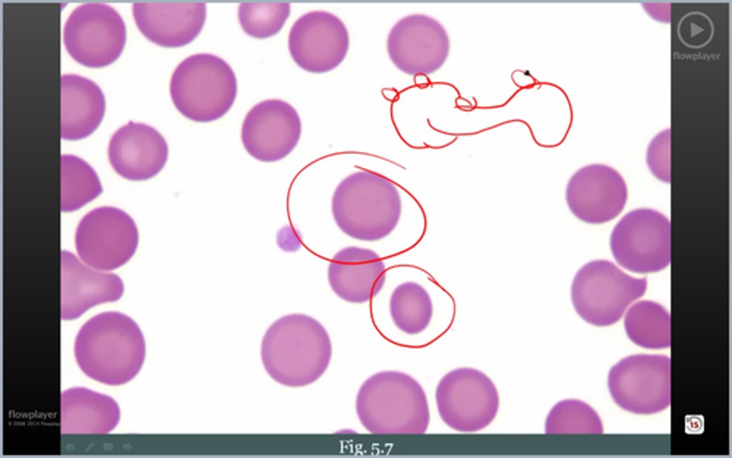 <p>what's wrong w/ cells here</p>