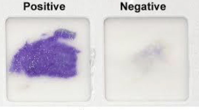 <p>Oxidase reagent </p><p>purple=positive </p><p>Aerobic gram negative bacteria</p>