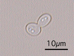 <p>What species of yeast has these results:</p><p>germ tube: -</p><p>blastoconidia ONLY</p>