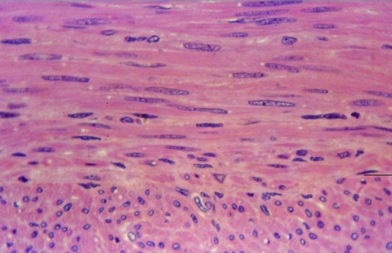 <p>Where is the smooth muscle tissue found?</p>