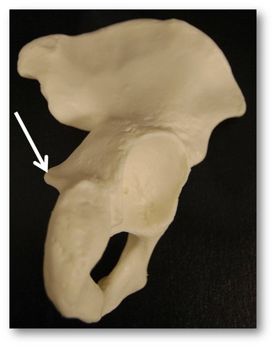 Name this specific part of the pelvic bone.