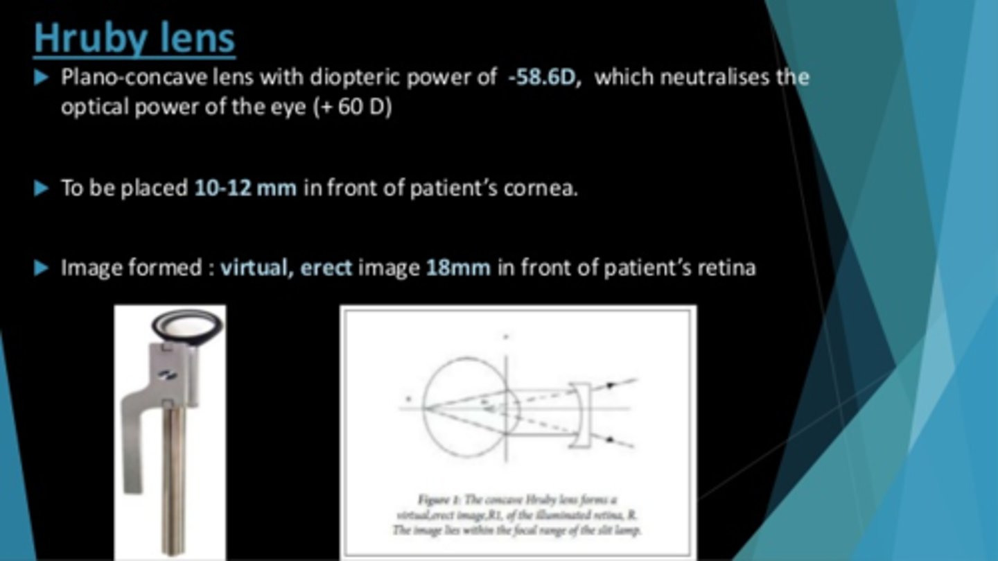 <p>B. Hruby lens</p><p>* It is held immediately in front of the cornea and forms a virtual, erect, and minified image of the retina</p><p>* A Koeppe lens allows examination of both the angle and the posterior pole</p>