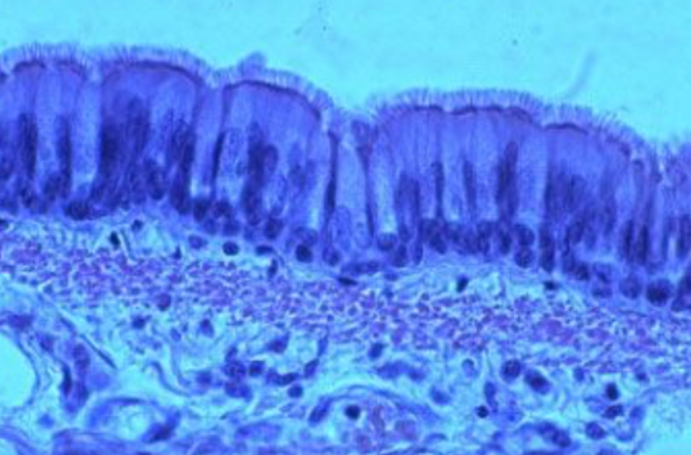 <p>pseudostratified</p>