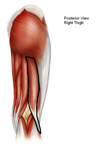 <p><strong><sub><sup>Hamstrings:</sup></sub> Biceps Femoris (long head) </strong><sub><sup>(bi-articular muscle)</sup></sub></p><ul><li><p><span style="color: rgb(47, 249, 22)">Origin</span>: Ischial Tuberosity</p></li><li><p><span style="color: rgb(13, 177, 255)">Insertion</span>: Proximal Fibula</p></li><li><p><span style="color: rgb(255, 0, 0)">Action</span>: <strong>Extends</strong> thigh at hip joint; <strong>flexes</strong> leg at knee joint</p></li></ul><p></p>