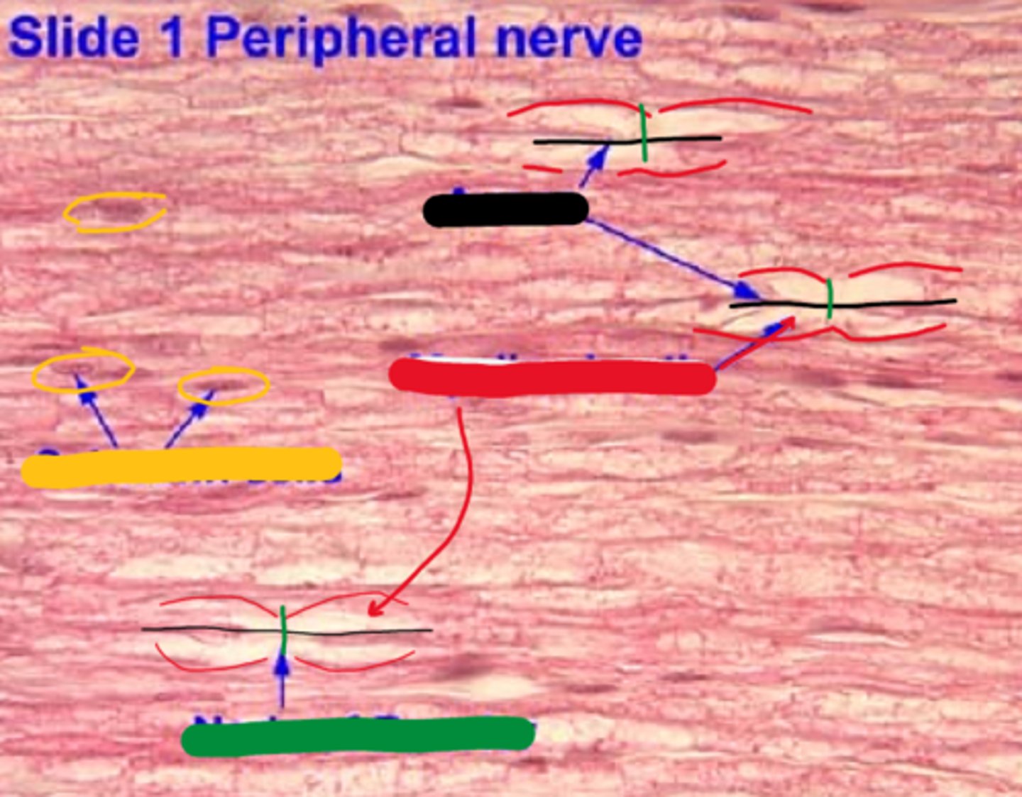 <p>what was the white space filled with in vivo?</p>