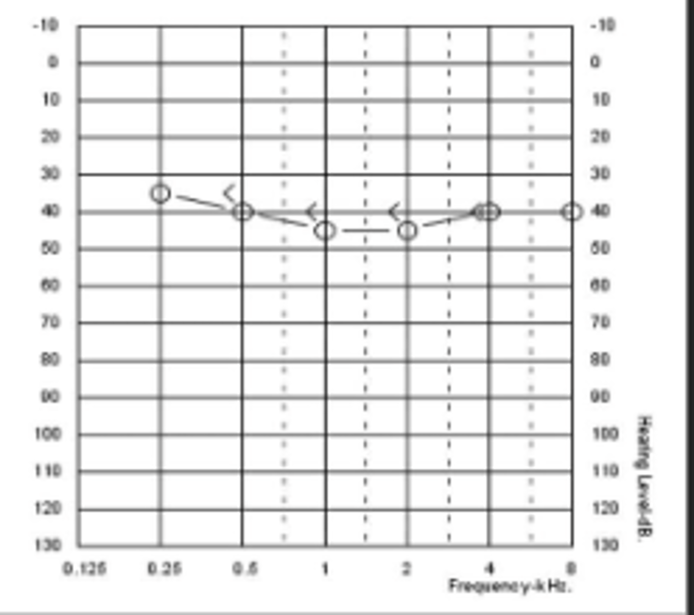 <p>Which of the below options is most likely to be the patient's SRT?</p>