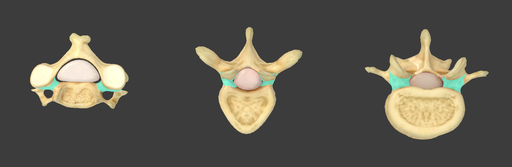 <p>what component of vertebrae is this?</p>