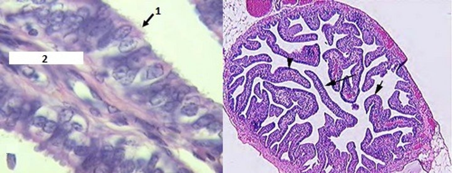 <p>Identify the organ &amp; #1 &amp; 2. List the tunica and their characteristics.</p>