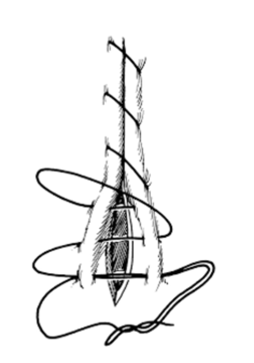 <p>- Bites on each side of the incision, perpendicular to the incision, pass into serosa, through muscularis and deep to submucosa, then passes back out without entering the lumen.</p>