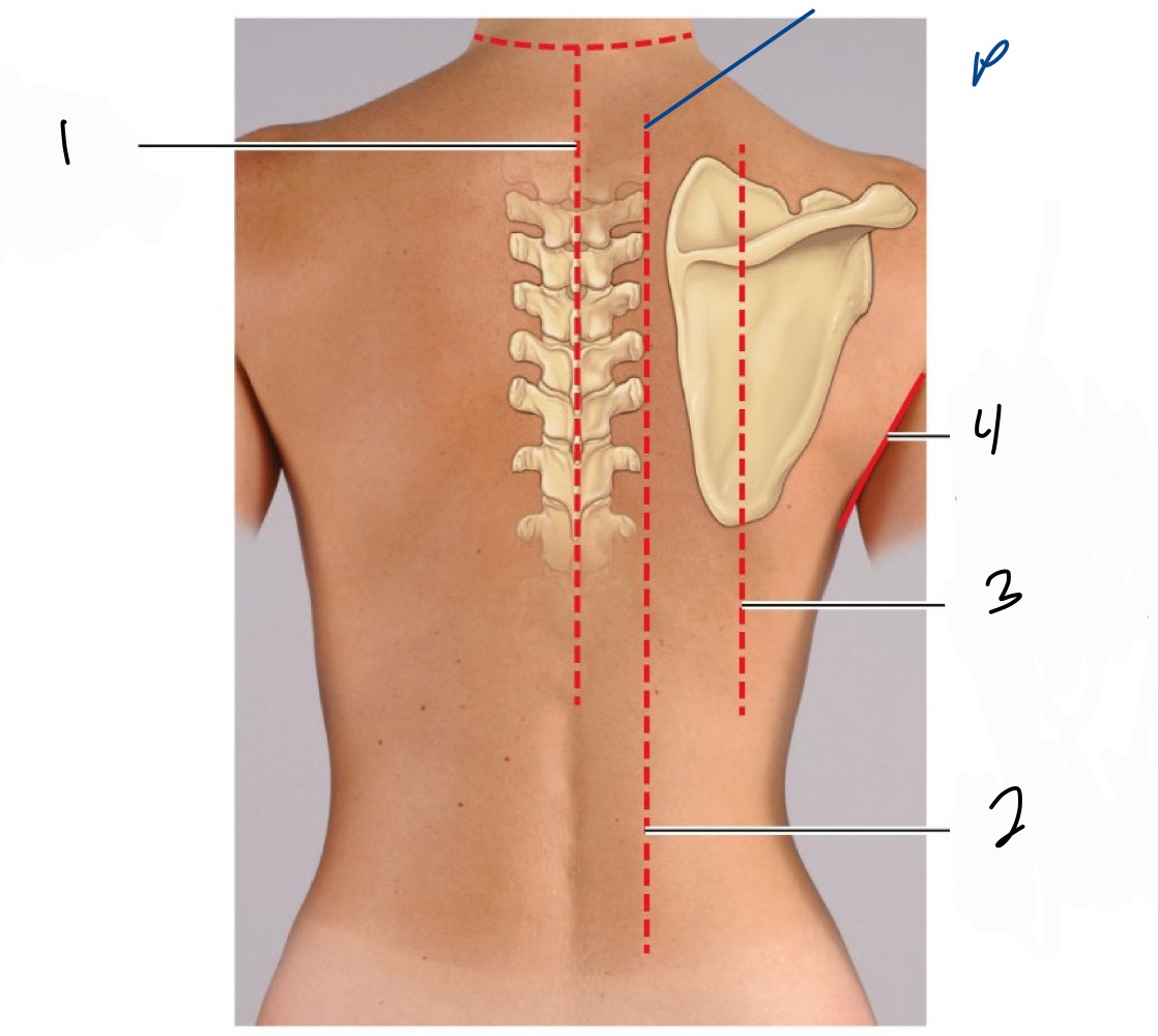 <p>1 Post. median line</p><ol start="2"><li><p>paravertebral line</p></li><li><p>scapular line</p></li><li><p>post. axillary</p></li></ol><p></p>
